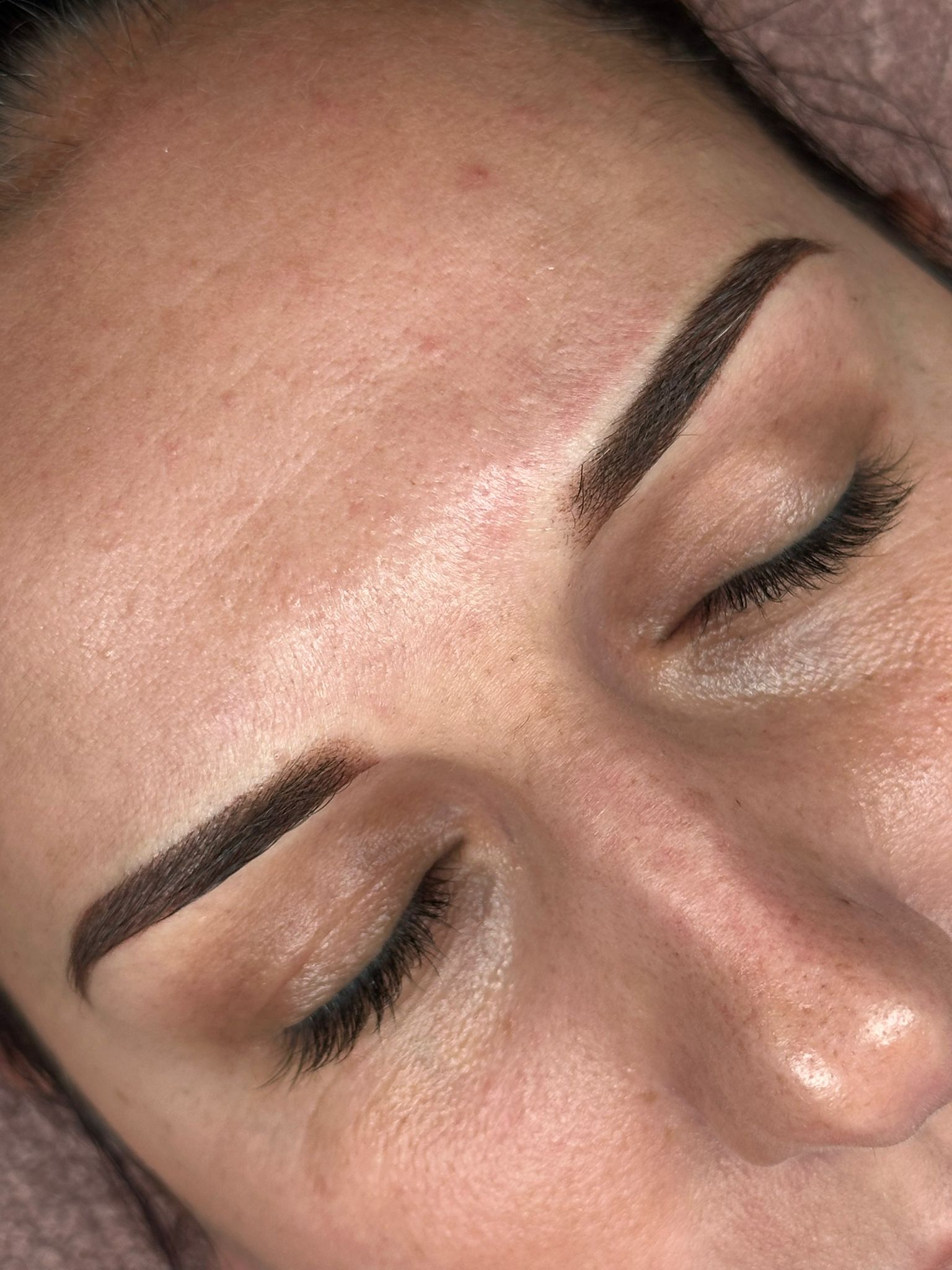 Dermopigmentation